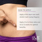 Belli Skincare Stretch Mark Cream for Pregnancy, Shea Butter & Coconut Body Moisturizer with Vitamin E, Paraben Free, Dermatologist Recommended, (6.5 Oz)