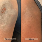 Blossom Essentials Honey Salve - Organic Manuka Honey Hydration Repair - Eczema Relief for Dry, Itchy, Sensitive Skin - Soothing Moisturizer & Balm for Kids, Adults - Made in USA - 4oz