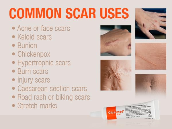 Silicone Scar Gel - Works with Tape - Advanced Cream for Surgical Scars, C-Section, Burns, Keloids, and Acne Marks - 0.5 oz (15g)