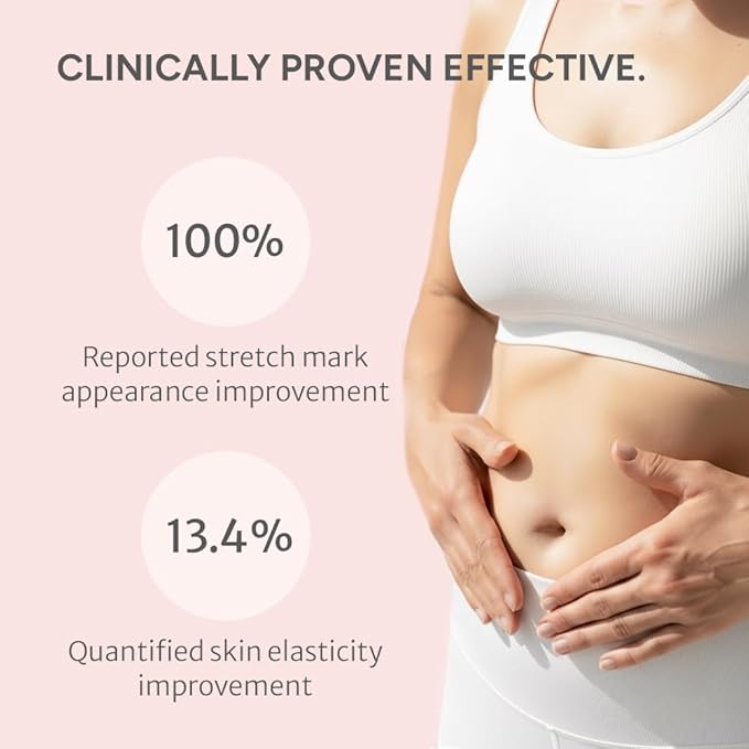 Advanced Stretch Mark Cream for Pregnancy, Weight Gain, Growth Spurts - Pregnancy-Safe - Korean Skincare - Clinically Proven - Ultra Clean Ingredients - Fragrance Free - Vegan - 6.76 fl oz