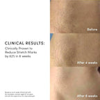 Evereden Golden Belly Serum, 1.7 fl oz. | Clean & Vegan Women's Belly Oil for Pregnancy and Postpartum | Clean Maternity Skincare | Non-Toxic Stretch Mark Oil