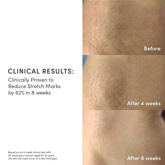 Evereden Golden Belly Serum, 1.7 fl oz. | Clean & Vegan Women's Belly Oil for Pregnancy and Postpartum | Clean Maternity Skincare | Non-Toxic Stretch Mark Oil