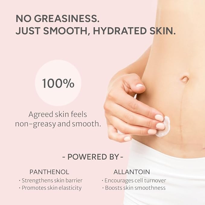 Advanced Stretch Mark Cream for Pregnancy, Weight Gain, Growth Spurts - Pregnancy-Safe - Korean Skincare - Clinically Proven - Ultra Clean Ingredients - Fragrance Free - Vegan - 6.76 fl oz