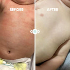 Baby Eczema Relief Balm, Healing Ointment Baby Moisturizing Cream for Eczema, Dry, Itchy Skin. Award Winning Baby Skincare for Sensitive Skin, Safe for Newborns, Kids and Adults