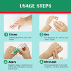 Advance Silicone Scar Cream Gel: Old & New Scars Treatment Stretch Marks Removal - Body Face Surgical Skin Healing - Recovery C-Section Keloids Injury Acne Wound Dark Spot for Kids 1oz (30 g) (Green)