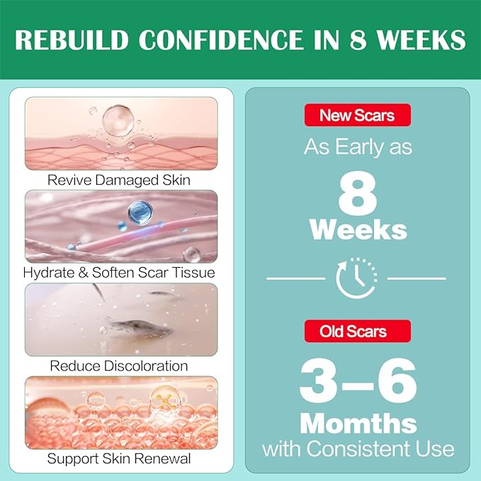 Advance Silicone Scar Cream Gel: Old & New Scars Treatment Stretch Marks Removal - Body Face Surgical Skin Healing - Recovery C-Section Keloids Injury Acne Wound Dark Spot for Kids 1oz (30 g) (Green)