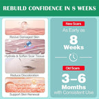 Advance Silicone Scar Cream Gel: Old & New Scars Treatment Stretch Marks Removal - Body Face Surgical Skin Healing - Recovery C-Section Keloids Injury Acne Wound Dark Spot for Kids 1oz (30 g) (Green)