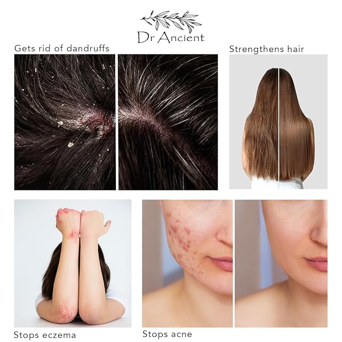 Dr.Ancient Bittim Soap + Aleppo Soap Organic Natural Vegan Traditional Handmade Antique - Absolutely No Chemicals!