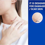 Advanced Scar Gel for Surgical Scars, Face, Body, Legs, Burns, Acne, C-Section, Stretch Marks, Keloids - Effective Scar Removal for Men and Women, Suitable for Old & New Scars (100% New -2 Bottle)