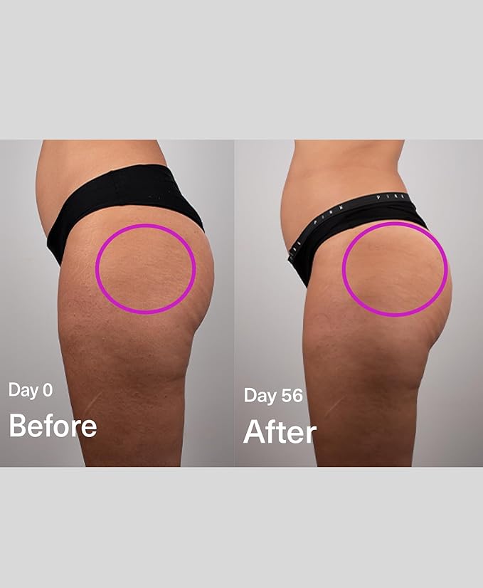 SickScience DropOff Advanced Exosome Body Firming & Sculpting Cream | Targets Stretch Marks, Cellulite, the Belly Area & Loose Skin, Including After Pregnancy, 100ml