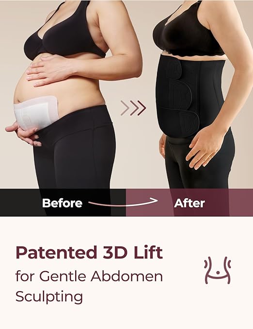 Momcozy Ergowrap Postpartum Belly Band for Natural and C-Section Recovery, Abdominal Binder with 3D Abdomen Lifting & Ergonomic Back Support, Seamless Belly Wrap Shapewear for Post Surgery Recovery