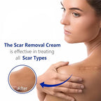 Advanced Scar Gel for Surgical Scars, Face, Body, Legs, Burns, Acne, C-Section, Stretch Marks, Keloids - Effective Scar Removal for Men and Women, Suitable for Old & New Scars (100% New -1 Bottle)