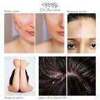 Dr.Ancient Stinging Nettle Soap + Pine Tar Soap Organic Natural Vegan Traditional Handmade Antique - Absolutely No Chemicals!