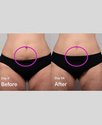 SickScience DropOff Advanced Exosome Body Firming & Sculpting Cream | Targets Stretch Marks, Cellulite, the Belly Area & Loose Skin, Including After Pregnancy, 100ml