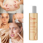 Stretch Mark Pregnancy Oil, Natural Oil Skincare Body Oil Serum for Scars and Stretch Marks, Face with Vitamin E & A for Sensitive Dry Skin and Body Moisturizer