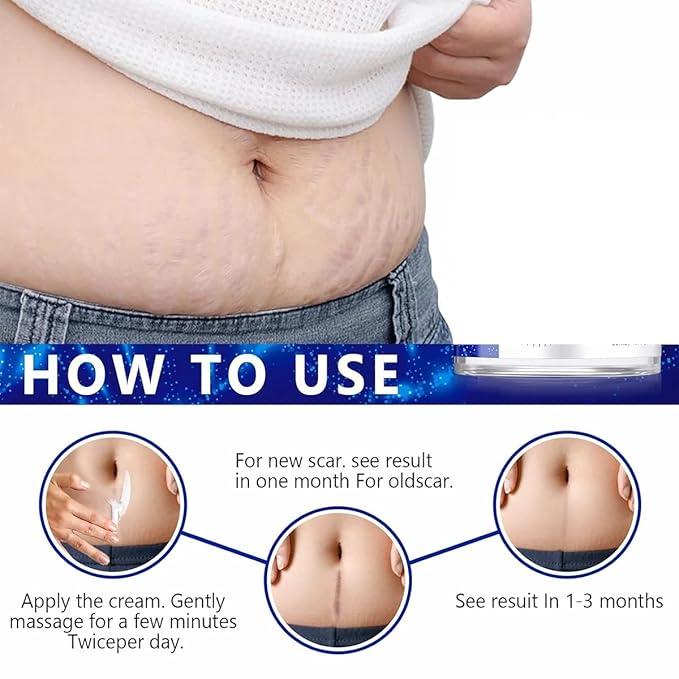 Advanced Scar Gel for Surgical Scars, Face, Body, Legs, Burns, Acne, C-Section, Stretch Marks, Keloids - Effective Scar Removal for Men and Women, Suitable for Old & New Scars (100% New -1 Bottle)