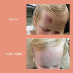 CLMD - TrueLipids Boo-Boo & Bum Balm – Soothing Baby Balm for Diaper Rash, Cuts, Scrapes & Burns – Non-Toxic, Hypoallergenic – Organic Skin Relief – 1.7 fl oz