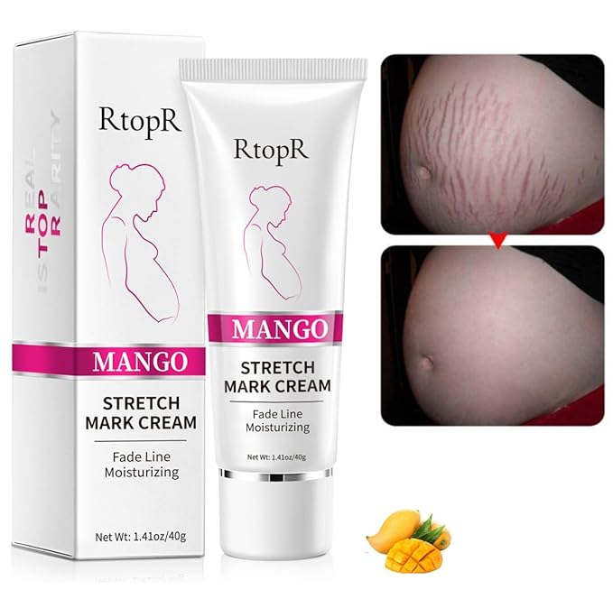 2 PCS Stretch Marks and Scar Cream, Stretch Mark and Scar Removal Cream for Pregnancy, Belly Creams for Wrinkles, Obesity Fat Marks Scars Moisturizing, Remove Marks