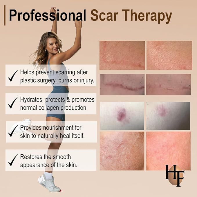 HealFast The Original Scar Cream for Stretch Marks – Soothes, Nourishes and Refreshes Skin – Using Ovasome Technology with Allantoin & Alpha LIpoic Acid – 2 Oz/ 60 ml