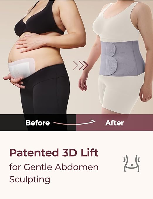 Momcozy Ergowrap Postpartum Belly Band for Natural and C-Section Recovery, Abdominal Binder with 3D Abdomen Lifting & Ergonomic Back Support, Seamless Belly Wrap Shapewear for Post Surgery Recovery