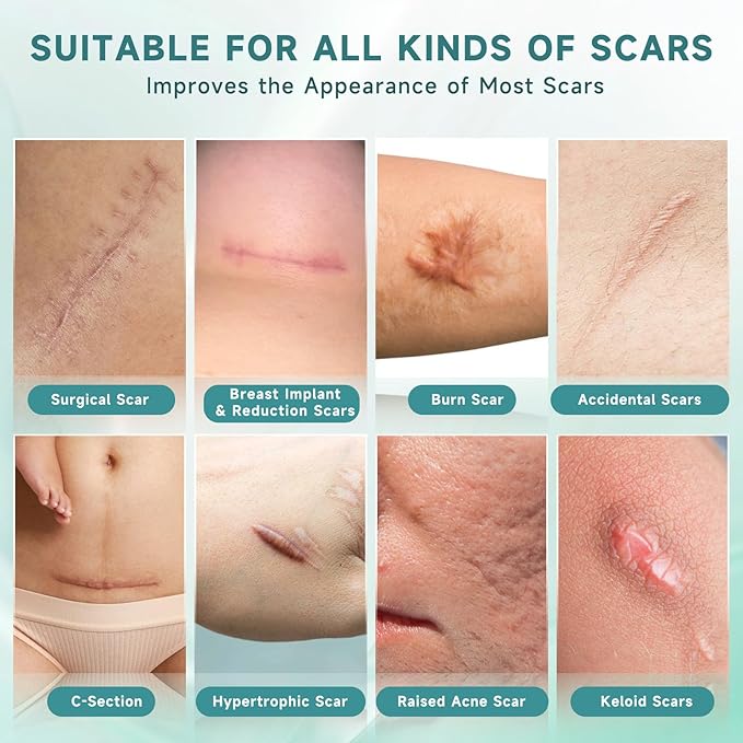 Advanced Silicone Scar Cream and Scar Sheets, Professional Scar Repair Kit for Surgical Scars, Stretch Marks, Old and New Scars
