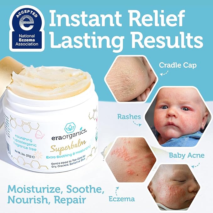 Era Organics Healing Ointment for Babies - USDA Certified Organic Natural Moisturizer Gentle on Sensitive Skin Prone To Baby Eczema, Cradle Cap (Infant Seborrheic Dermatitis), Rashes, Hives and More