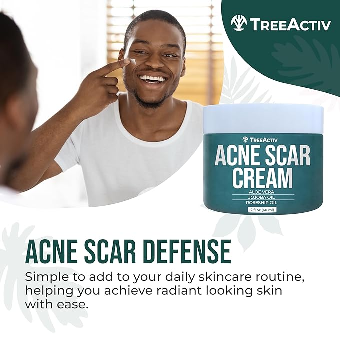 TreeActiv Acne Scar Cream, 2 fl oz, Scar Cream for Face and Dark Spot Remover, Lotion for Stretch Marks and Body, Acne Scar Removal for All Skin Types, 500+ Uses