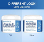 Hermon Jock Itch Antifungal Cream, Ringworm Treatment for Humans, Psoriasis Treatment, Psoriasis Scalp Treatment, Ringworm Cream for Humans, Foot & Body Balm, Provides Soothing Relief-100ml