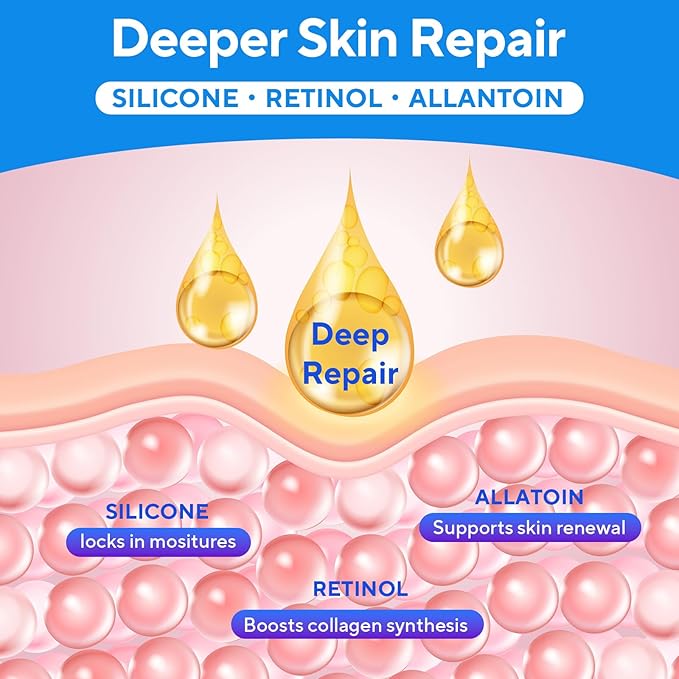 Scar Cream, Silicone Scar Gel, Advanced Scar Removal Cream for Surgical Scars, Stretch Marks, Keloid Bump Removal, Injuries, Burns and Acne, Old and New Scars, Gentle on Sensitive Skin, 1.7 oz(50ml)