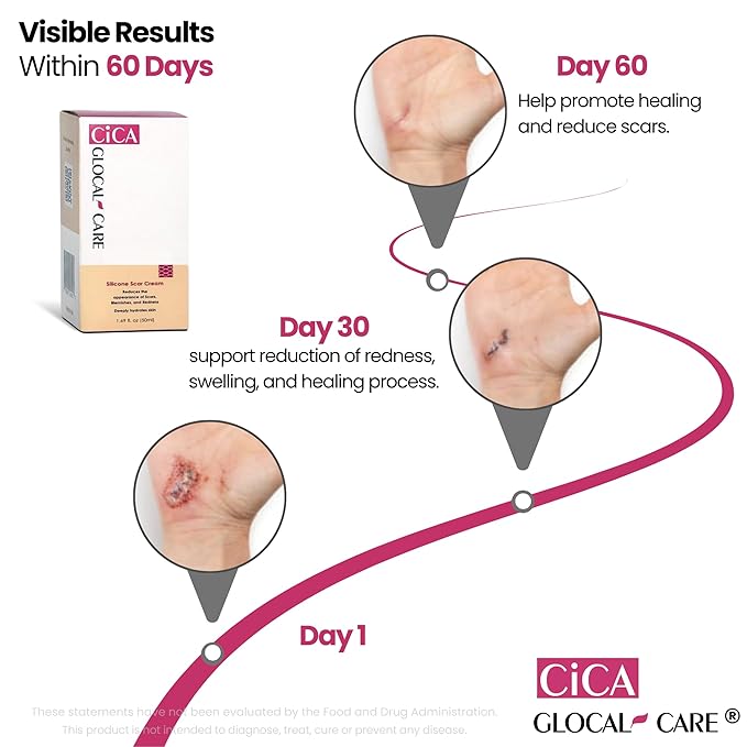 CICA Silicone Scar Cream – New & Old Scar, Stretch Marks & PIH Appearance Improvement - Medical-Grade Silicone with TECA, PASSIOLINE, Hyaluronic Acid & Panthenol - Supports Wound Healing - 50 ml