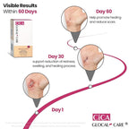 CICA Silicone Scar Cream – New & Old Scar, Stretch Marks & PIH Appearance Improvement - Medical-Grade Silicone with TECA, PASSIOLINE, Hyaluronic Acid & Panthenol - Supports Wound Healing - 50 ml