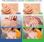 Hermon Jock Itch Antifungal Cream, Ringworm Treatment for Humans, Psoriasis Treatment, Psoriasis Scalp Treatment, Ringworm Cream for Humans, Foot & Body Balm, Provides Soothing Relief-100ml