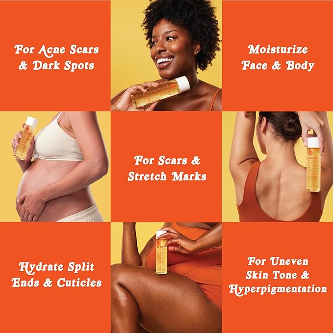 Bio-Oil Natural Skincare Oil Serum, Face and Body Moisturizer with Chamomile, Rosehip, and Lavender Oil, for Scars, Stretch Marks, Sensitive Skin, All Skin Types, 2 Oz
