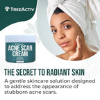 TreeActiv Acne Scar Cream, 2 fl oz, Scar Cream for Face and Dark Spot Remover, Lotion for Stretch Marks and Body, Acne Scar Removal for All Skin Types, 500+ Uses