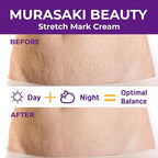 Stretch Mark Cream Prevention for Pregnancy - Maternity Cream for Stretch Marks Removal | Nourishing Formula – Prevents Stretch Marks & Improves Elasticity - 4 oz (120g) (4 oz (120g))