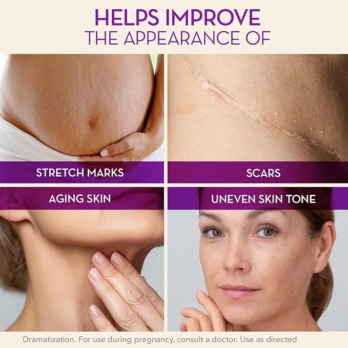 Cicatricure Cica Oil for Stretch Marks & Scars, Visible Results in 4 Weeks, Pregnancy Must-Haves Body Oil with Vitamin E, Stretch Mark Oil, Scar Treatment with Botanical Ingredients, 6.7 fl oz