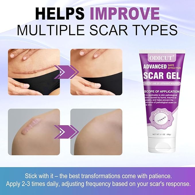 Silicone Scar Gel, Intensive Scar Cream, 2.1oz Keloid Bump Removal for Stretch Marks Removal, Surgical Scars, Cesarean Section, Acne, Injury, Burns, Doctor-tested Scar Improvement (60g)