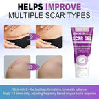 Silicone Scar Gel, Intensive Scar Cream, 2.1oz Keloid Bump Removal for Stretch Marks Removal, Surgical Scars, Cesarean Section, Acne, Injury, Burns, Doctor-tested Scar Improvement (60g)