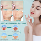 Advanced Scar Cream, Silicone Gel for Scars, Professional Scar Removal Cream for Surgical Scars, Stretch Marks, Old and New Scars 1.7 oz(50ml)