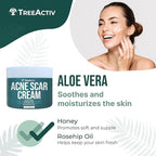 TreeActiv Acne Scar Cream, 2 fl oz, Scar Cream for Face and Dark Spot Remover, Lotion for Stretch Marks and Body, Acne Scar Removal for All Skin Types, 500+ Uses