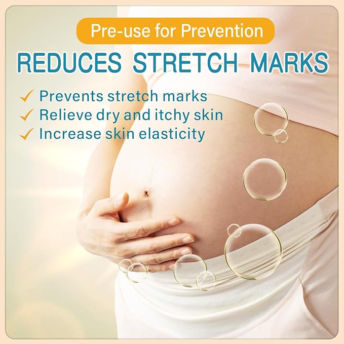 PEGO Stretch Mark Oil for Pregnancy, Maternity Body Oil for Stretch Mark Prevention & Reduction, Hydrating Skin Care, 5.41oz (Oil+Cream)