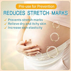 PEGO Stretch Mark Oil for Pregnancy, Maternity Body Oil for Stretch Mark Prevention & Reduction, Hydrating Skin Care, 5.41oz (Oil+Cream)