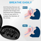 Anti Snoring Devices, Nasal Dilator for Sleeping, Effective to Relieve Snoring, for Nasal Snorers, Reusable Snoring Device to Enjoy a Peaceful Night's Sleep - 3 Pack (M)