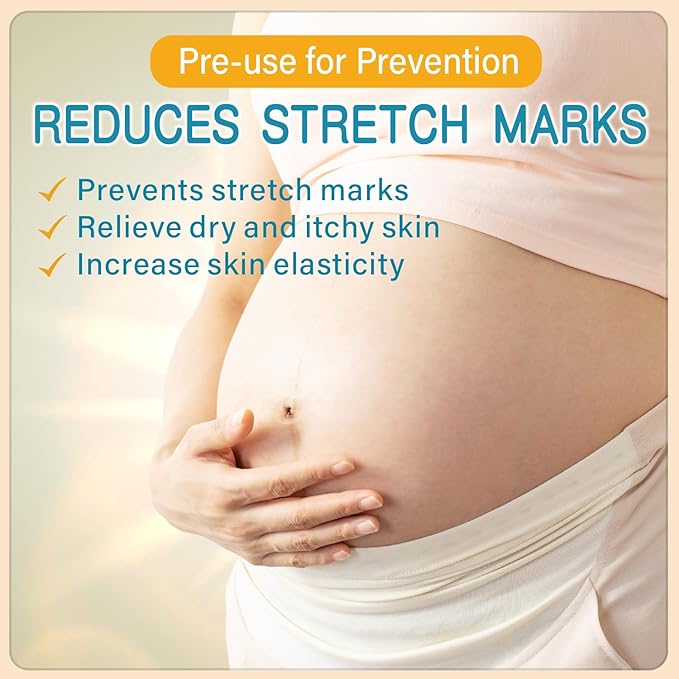 Stretch Mark Cream for Pregnancy - Deep Repair & Prevention for Stretch Marks - Stretch Mark Oil/Lotion for Women - Prenatal & Postnatal Skin Care (1_Pack)