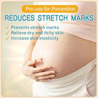 Stretch Mark Cream for Pregnancy - Deep Repair & Prevention for Stretch Marks - Stretch Mark Oil/Lotion for Women - Prenatal & Postnatal Skin Care (1_Pack)