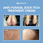 Hermon Jock Itch Antifungal Cream, Ringworm Treatment for Humans, Psoriasis Scalp Treatment, Ringworm Cream for Humans, Foot & Body Balm, Provides Soothing Relief-2 Pack