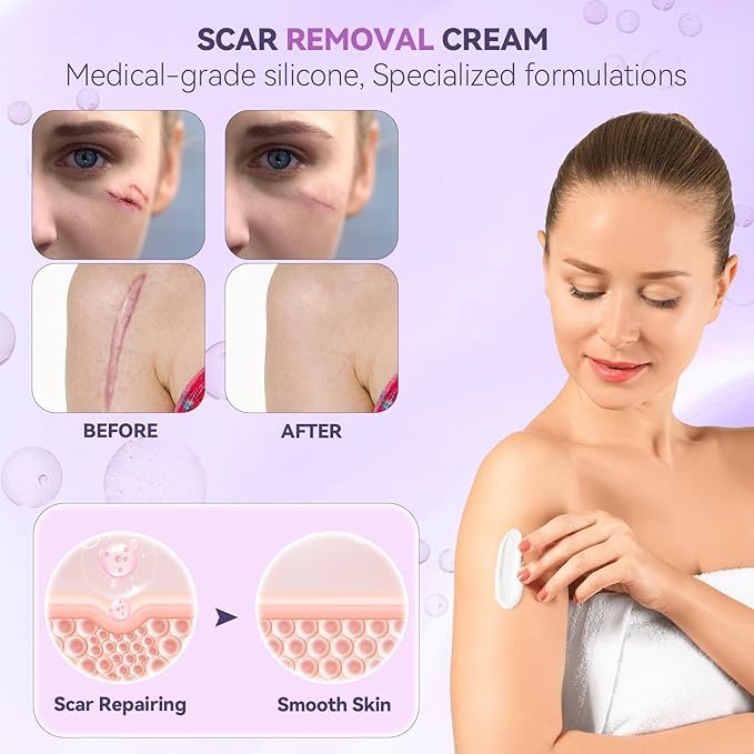 Advanced Scar Cream, Silicone Scar Gel for Old and New Scars, Scar Removal Cream for Surgical Scars, Stretch Marks, C-Section, Keloids, Injury, Acne, and More 1.7 oz(50ml)
