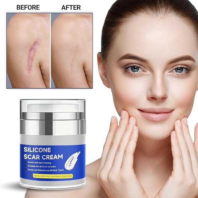 Silicone Scar Cream,Silicone Gel for Scars,Professional Scar Removal Cream for Surgical and Old Scars,Stretch Marks, Old and New Scars