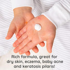 Bubbsi Whipped Coconut Oil Baby Lotion for Eczema, Dry Skin, Baby Acne, KP | Organic Coconut Oil, Shea Butter, Vitamin E | Light, Natural Scent | EU Compliant, Vegan (Refill Pouch, 32oz)