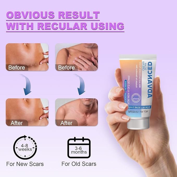 Silicone Scar Cream Scar Gel - Advanced Scar Treatment Keloid Bump Removal for Surgical Scars, C-Section, Injury, Stretch Marks, Acne, Burns, Keloids, Old & New Scars, 1.23Oz (35g)